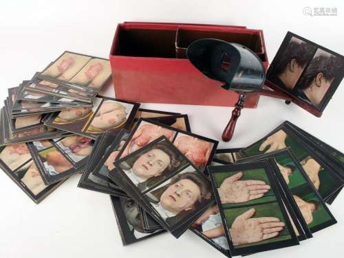 1911 SETÂ MEDICALÂ STEREOSCOPEÂ CARDS W VIEWER