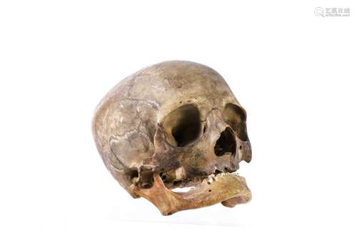 ANTIQUE HUMAN SKULL / SPECIMEN for MEDICAL STUDY