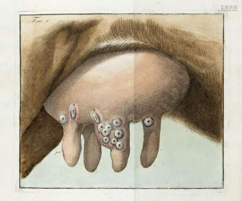 SACCO, Luigi (1769-1836) - Trattato di vaccinazione con