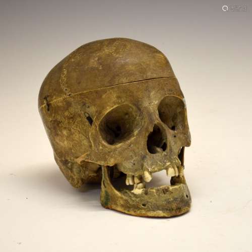 Medical/Dental Interest - Human skull, believed to have been used circa 1940's in Dental School