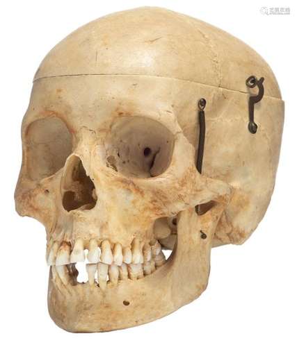 An articulated human skull, the upper cranium with…