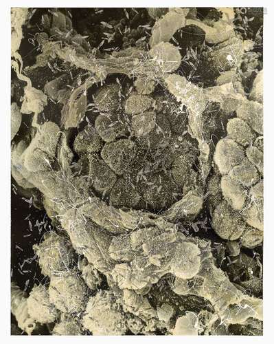 Damien Hirst, British b.1965- Second Series Biopsy: M132/246-Lung_cancer.