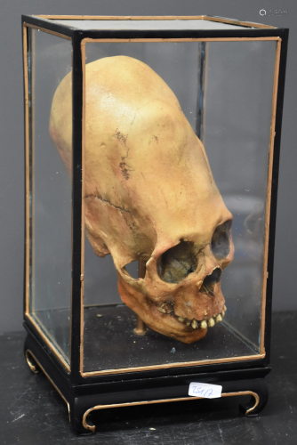 Curiosa. Realistic replica of a hydrocephalic skull.