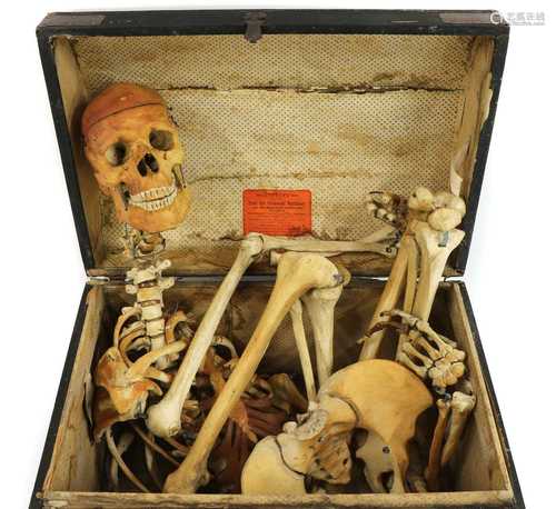 SKELETON IN A TRUNK,