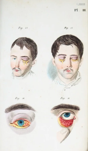 Medicine-Ophthalmia. FLORIO. Descrizione istorica