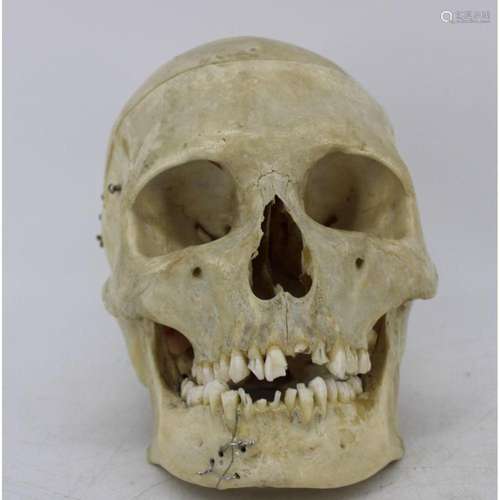 Antique Medical Human Skull.