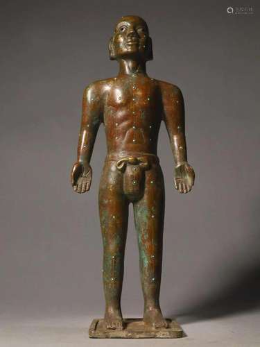 A Bronze Tophus-Inlaid 'Acupuncture' Figure