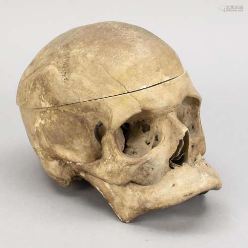 Skull of a Homo Sapiens, anatomica