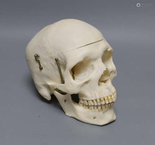 A human male skull, the vendor bought the item prior to 1977