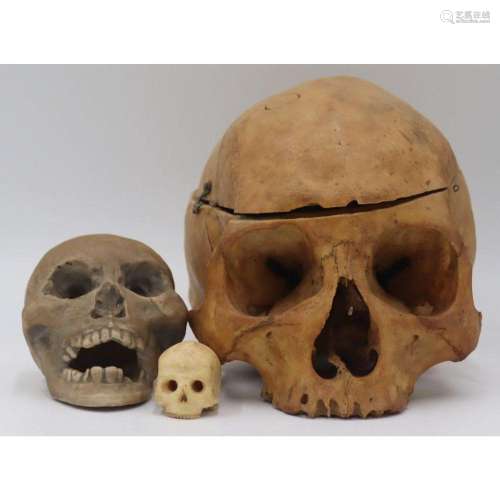 Antique Medical Human Skull with Hinged Cap.