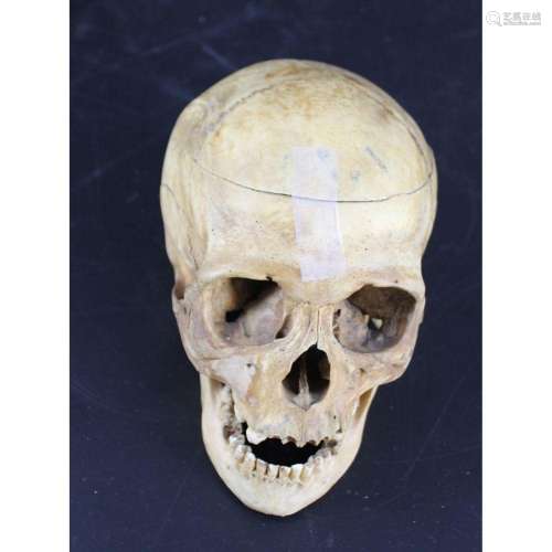 Antique Human Medical Skull.