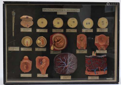 Modèle anatomique organes internes de femme en cirePoids: 5....