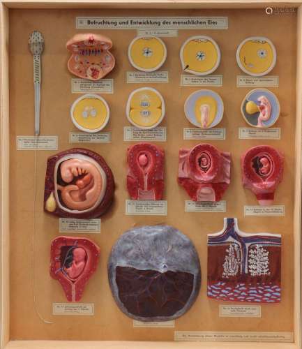 Modèle anatomique organes internes de femme en cirePoids: 4....