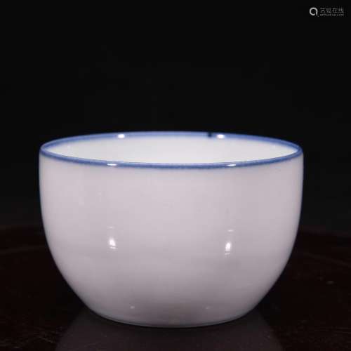S relationship with the treasure Zhu Wenyin glass cup 5-7.9 ...