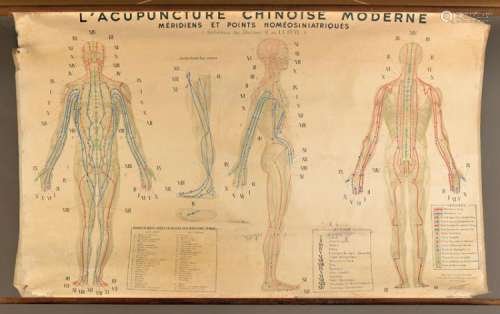 display to Acupuncture