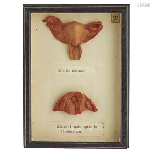 SIX CASED WAX MODELS OF HUMAN GESTATIONCIRCA 1930 in moulded ebonised glazed case frames, with