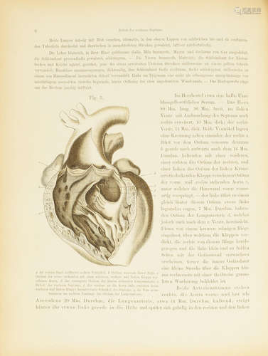 Die Defecte der Scheidewaende des Herzens. Pathologisch-Anatomische Abhandlung.  Vienna: Braumueller, 1875. ROKITANSKY, CARL VON. 1804-1878.