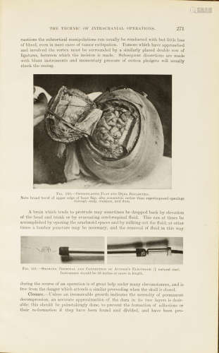 Surgery of the Head. Extracted from Surgery: Its Principles and Practice. Philadelphia: W.B. Saunders, 1908. CUSHING, HARVEY. 1869-1939.
