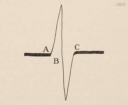 The electrocardiogram in clinical medicine: The string galvanometer and the electrocardiogram in health.  [Philadelphia and New York: American Journal of Medical Sciences], November 1910. JAMES, WALTER B.; AND HORATIO B. WILLIAMS.