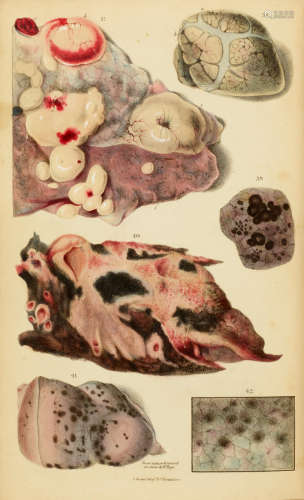 Principles and Illustrations of Morbid Anatomy. London: Whittaker & Co., 1834. HOPE, JAMES. 1801-1841.