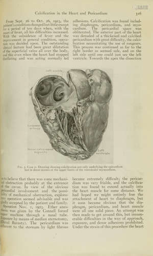 Selected Reprints of the Surgical Staff of the Brigham Hospital. [Cambridge, MA]: 1924. CUSHING, HARVEY. 1869-1939.