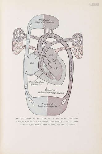 Congenital Malformations of the Heart. New York: The Commonwealth Fund, 1947. TAUSSIG, HELEN BROOKE. 1898-1986.