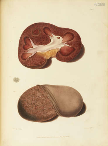 Reports of Medical Cases, Selected with a View of Illustrating the Symptoms and Cure of Diseases by a Reference to Morbid Anatomy. London: Longman, Rees, Orme, Brown, and Green, 1827-1831. BRIGHT, RICHARD. 1789-1858.