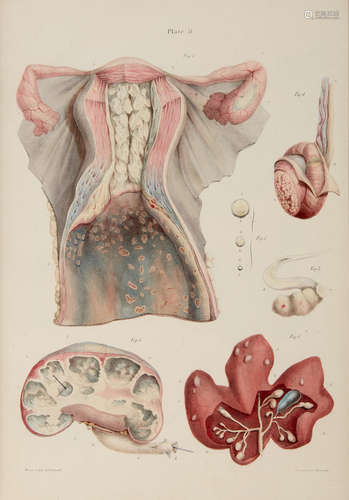 Pathological Anatomy. Illustrations of the Elementary Forms of Disease.  London: Longman, Orme, Brown, Green and Longman for the author, 1838.  CARSWELL, ROBERT. 1793-1857.