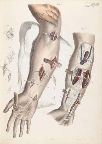 A Treatise on Operative Surgery. Philadelphia: Carey & Hart, 1844. PANCOAST, JOSEPH. 1805-1882.