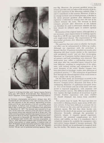 Archive of 26 items documenting the introduction and very early clinical experience with percutaneous transluminal coronary angioplasty: CORONARY ANGIOPLASTY. Gruentzig, Andreas, and others.