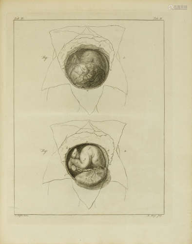 Observationes anatomico-pathologicae. Leiden: Pieter van der Eyk and Daniel Vygh, 1777-1781. SANDIFORT, EDUARD. 1825-1889.