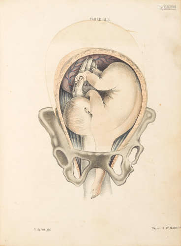 Obstetric Tables: Comprising Graphic Illustrations, with Descriptions and Practical Remarks; Exhibiting on Dissected Plates Many Important Subjects in Midwifery.  Philadelphia: James A. Bill, [1850]. SPRATT, GEORGE. 1784-1840.