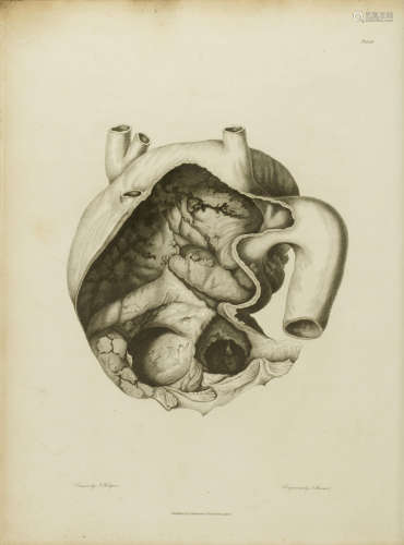 A treatise on the diseases of the arteries and veins containing the pathology and treatment of aneurisms and wounded arteries. London: Thomas Underwood, 1815. HODGSON, JOSEPH. 1788-1869.