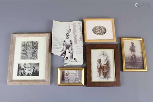 Six Vintage Indian Photographs, including a young Indian, afflicted with an inflammatory condition 'Elephant Leg', approx 9